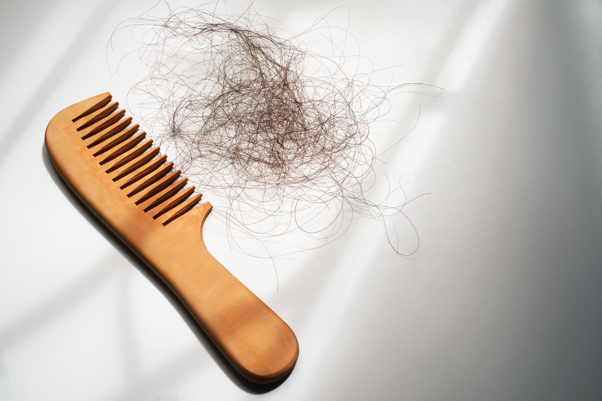 Hair Loss-udpated 7.14.26