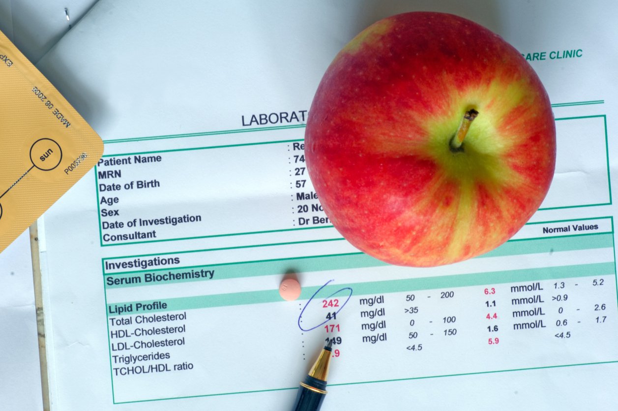 Cholesterol lab test report