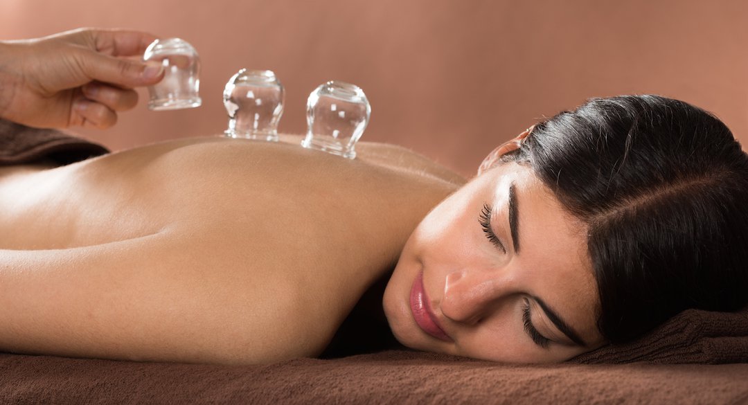 Woman Getting Cupping Treatment At Spa