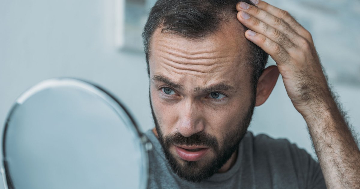Understanding Male Pattern Baldness | One Medical Understanding Male Pattern Baldness | One Medical