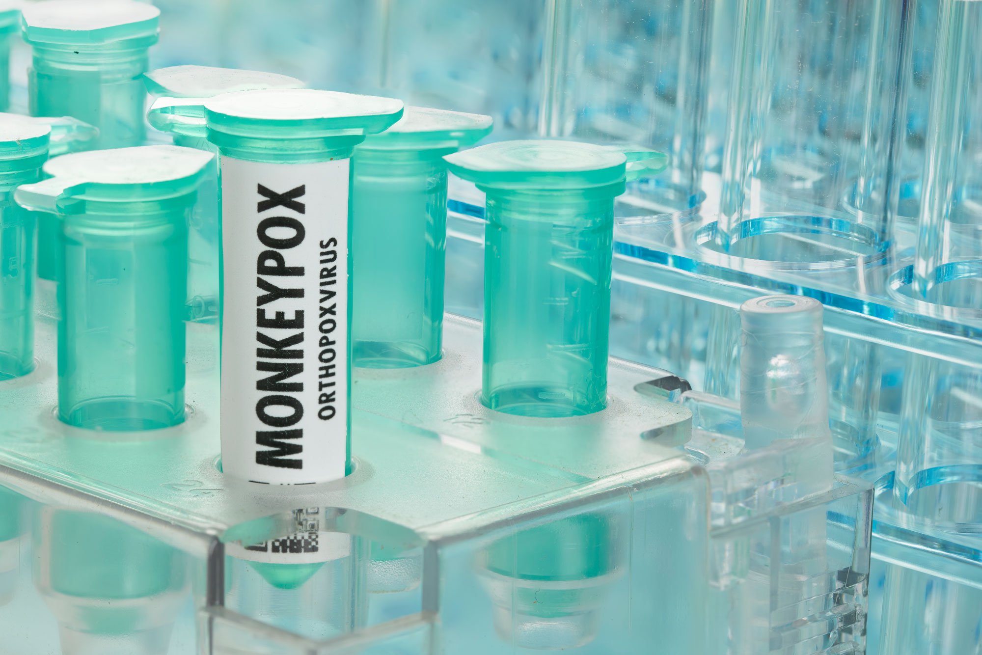 Monkeypox test tubes